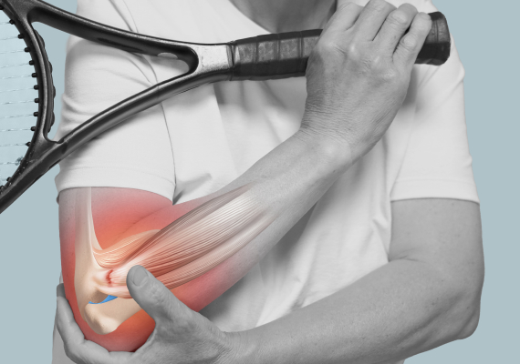 스포츠 재활 클리닉